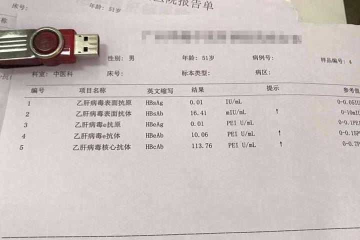 乙肝大三陽最新治療進展及策略概述